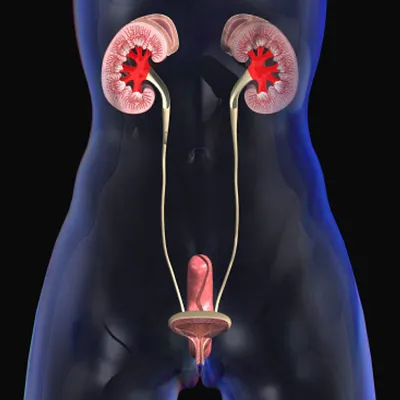 Ureteral Cancer